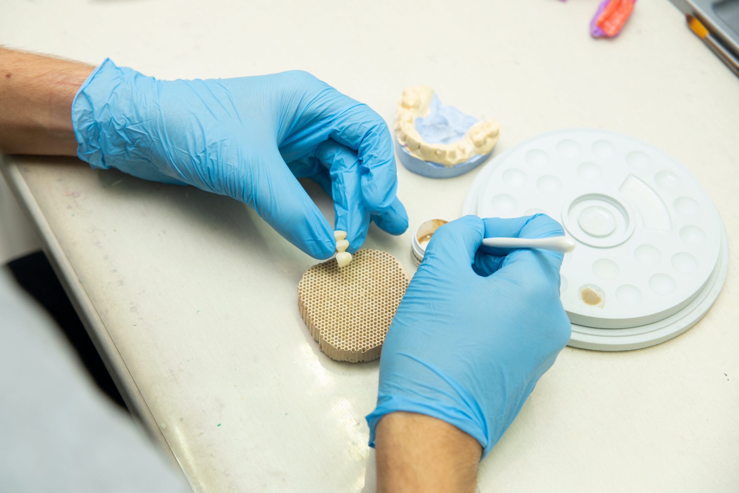 implant restoration