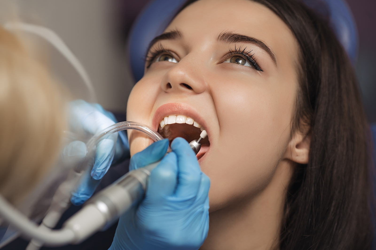 How Long Does Teeth Cleaning Take