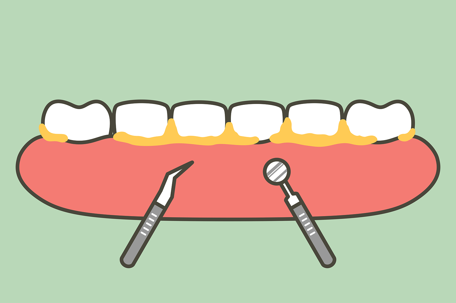 Bad Oral Hygiene and the Surprising Ways It Affects Your Health