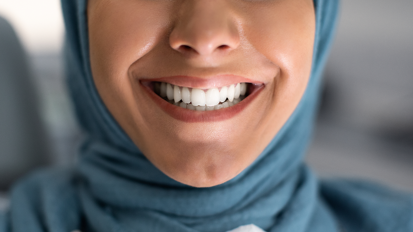 teeth whitening services