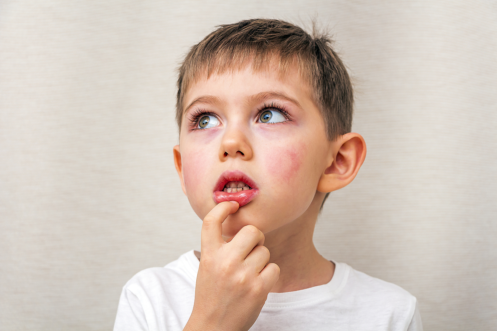 what causes crooked teeth