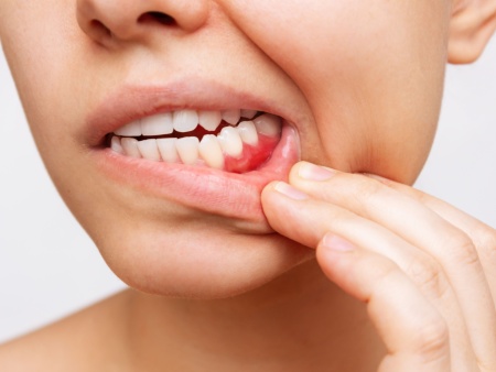 periodontal care