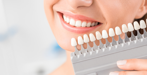 tooth whitening